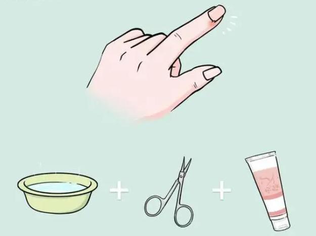 脚趾甲往肉里长又疼又痒教你一招,脚趾甲总往肉里扎该怎么办