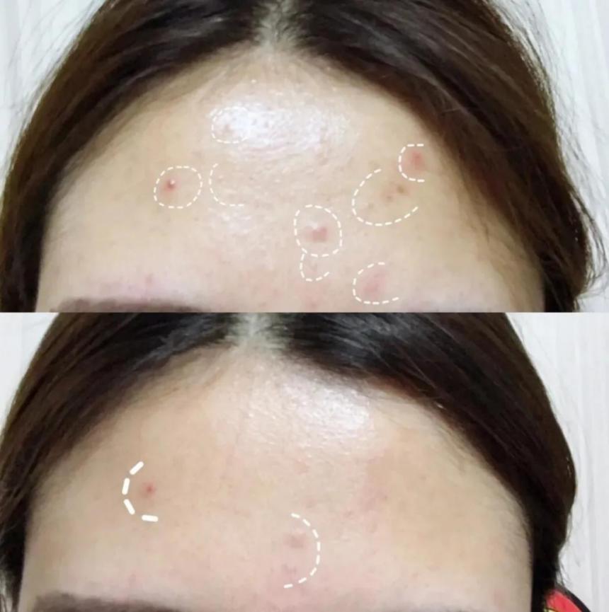 洗面奶黑名单,十大烂脸神器洗面奶排行榜