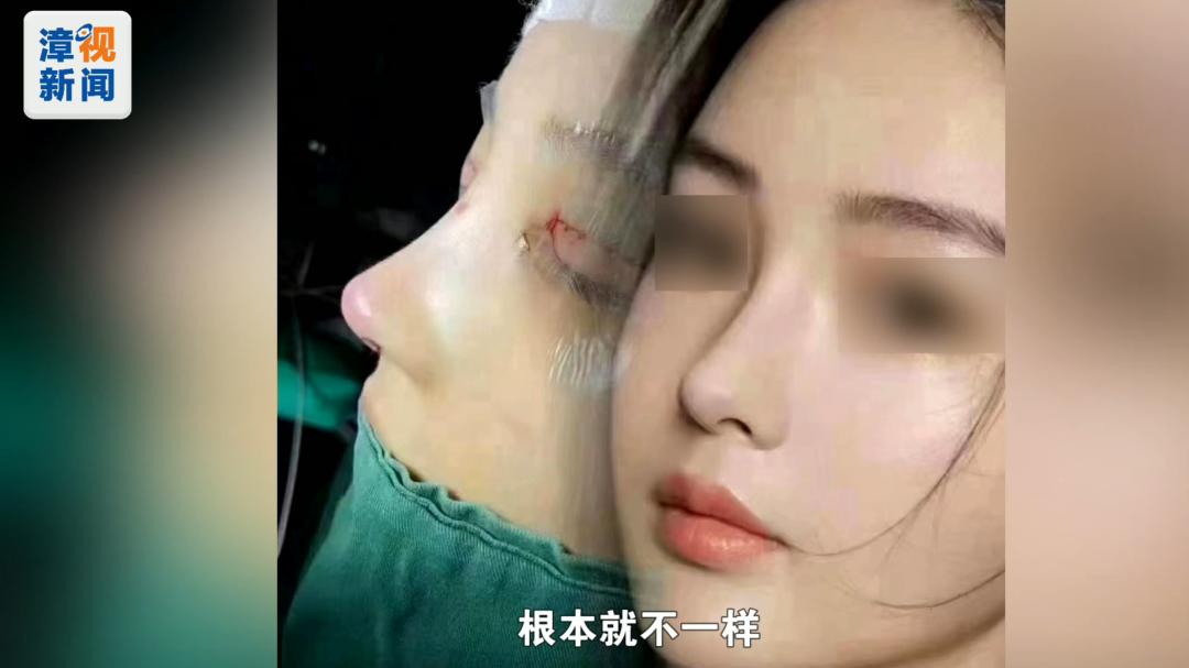 消费提醒|整容后,漳州一女子鼻子竟“动来动去”……