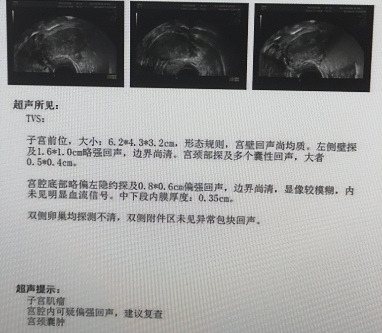 息肉是癌症的近亲,息肉是属于癌症吗