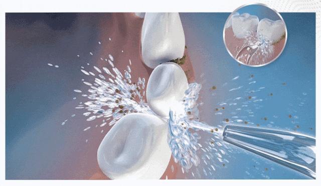 牙周炎导致的牙齿松动要不要拔掉,牙齿松动怎么办要拔牙吗