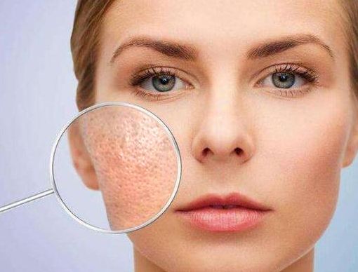 你的毛孔属于哪种,背上毛孔堵塞原因和解决方法