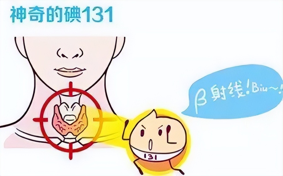 得了甲亢怎么办,孩子得了甲亢怎么办