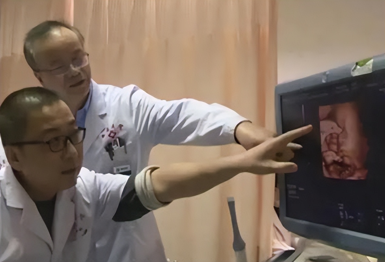 女人无子宫无卵巢,51岁女子试管生下4胞胎