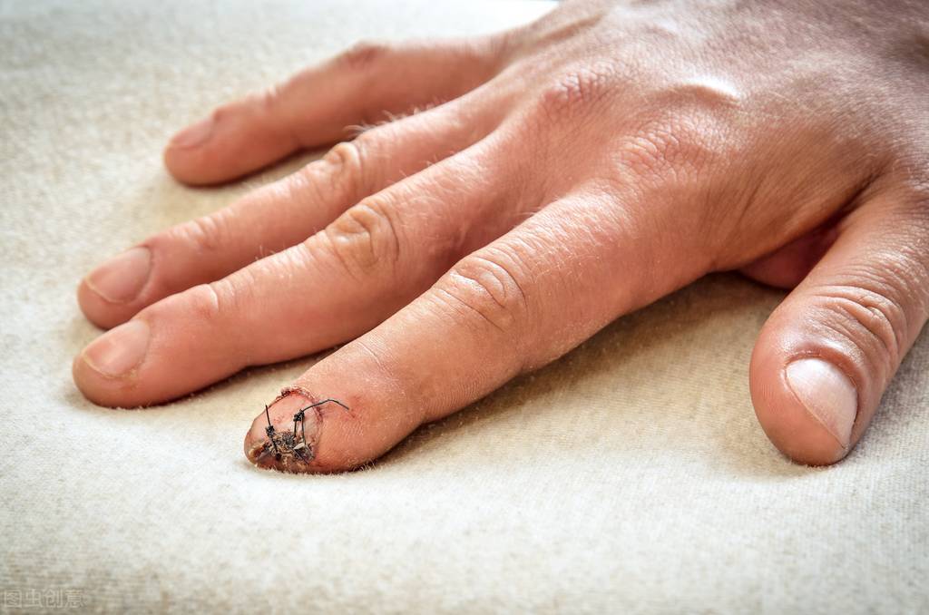 未经劳动部门认定为工伤，能以工伤直接要求赔偿吗?有无时间限制?