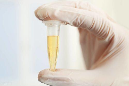 肾衰竭患者为什么表现要经常喝水,为什么肾衰竭人越来越多