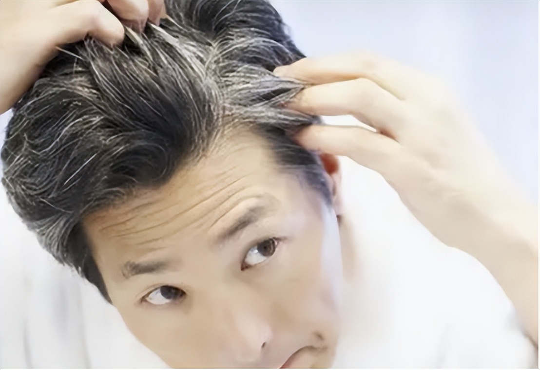 白头发越长越多到底是怎么回事,为什么白头发多了