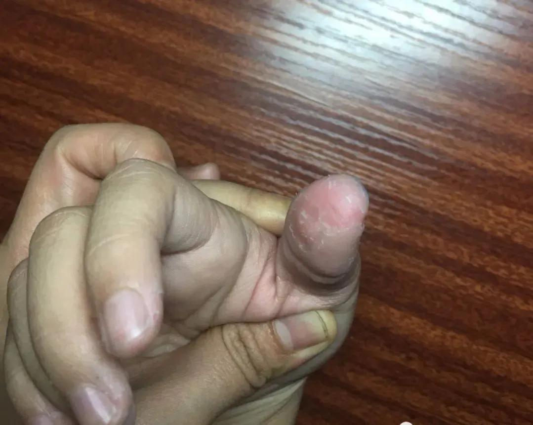 2岁孩子确诊asd,孩子确诊asd