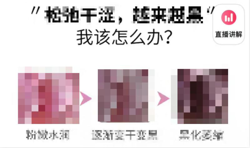 妇炎洁恶俗广告说明，这部女性健康宝典早该人手一本