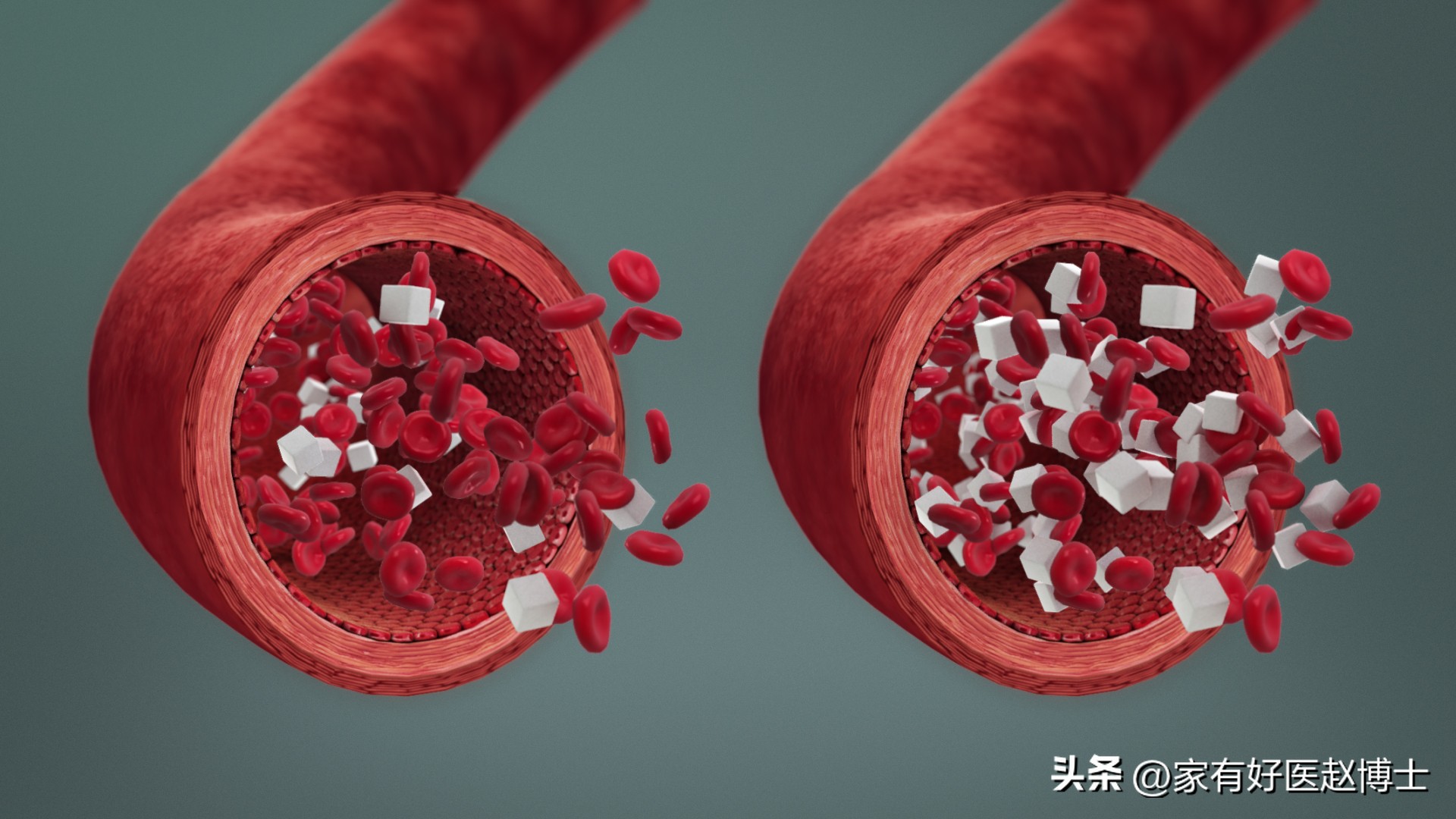 中国超过2亿人糖尿病,糖尿病人血糖100多严重吗