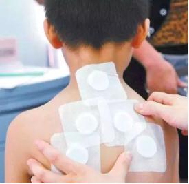 冬季三九灸是哪几天,今年三九灸是什么时间