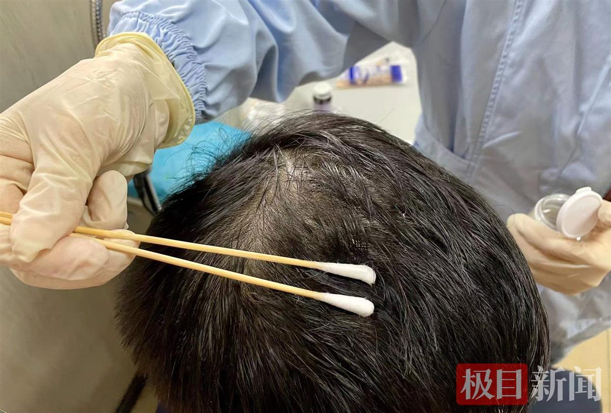 拿什么来拯救秃如其来的头发,秃如其来该拿什么拯救你的头发