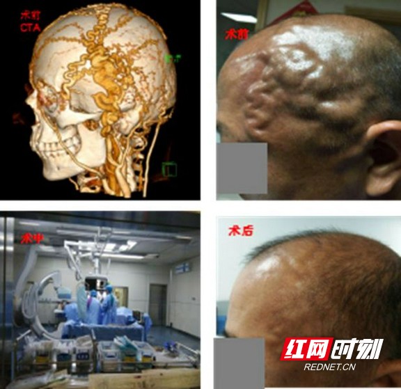 鐮ョ牶瀹炲共涔﹀啓鑽ｅ厜,鐮ョ牶瀹炲共