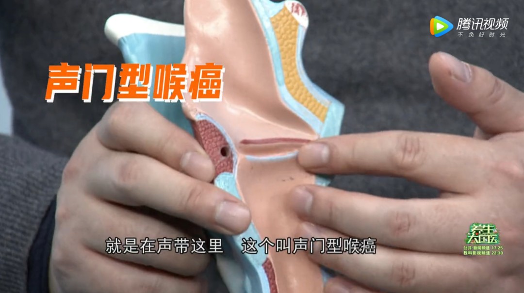 喉咙干痒、咳嗽你以为是咽喉炎？很可能是喉癌！40岁以上的男性注意了，你们是高发人群