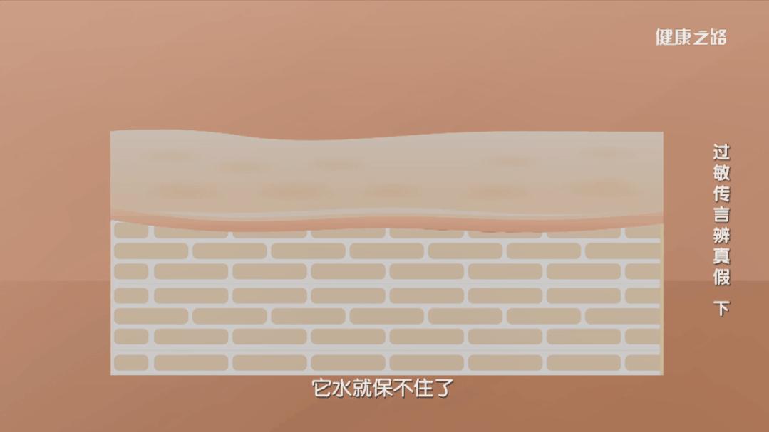 皮肤过敏需要注意的事项,皮肤过敏要护肤吗