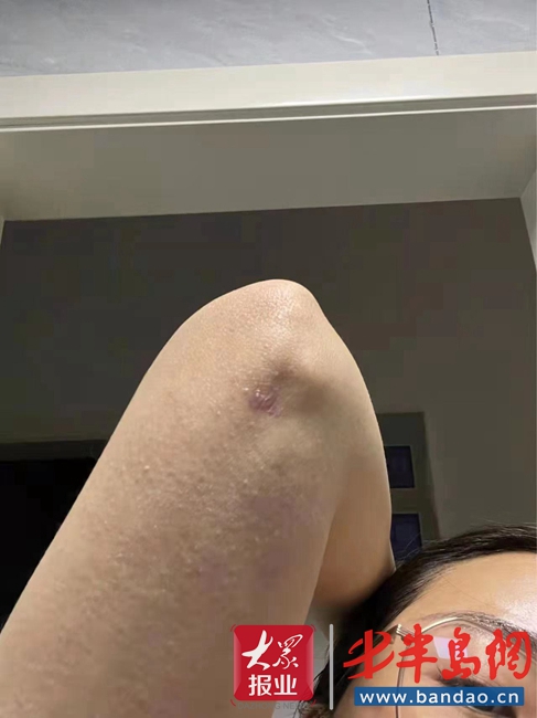 花了7万多元做整形,花了1600万整容失败