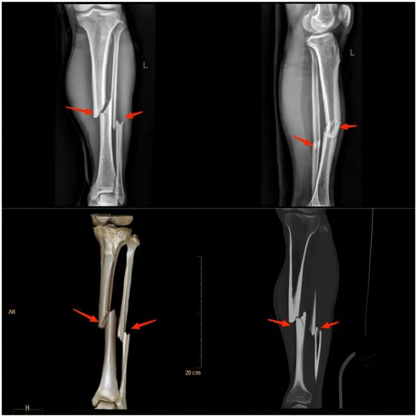 健康小知识运动损伤的常见症状,运动损伤知识科普宣传内容