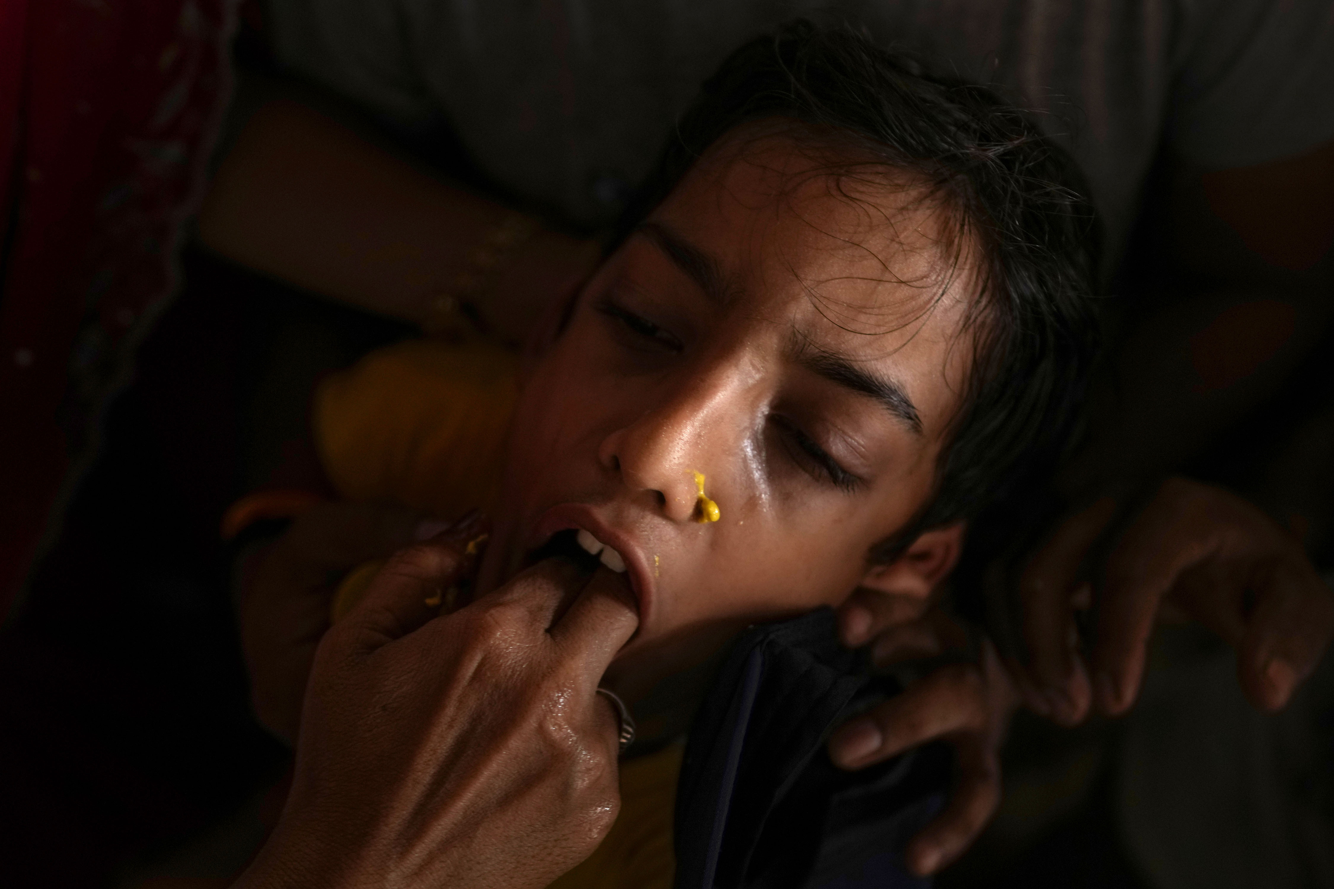 印度哮喘特效药配方,国外哮喘药吸入剂