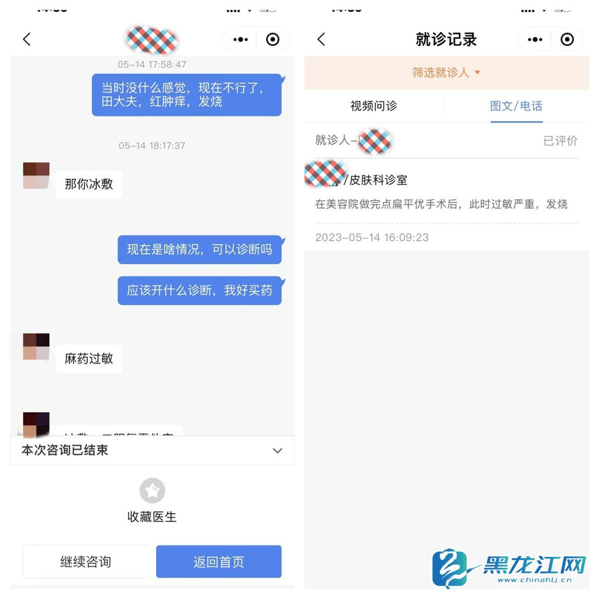 做了美容眼睛肿了过敏瘙痒,做美容被毁容的女孩